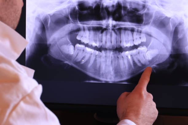 Best Emergency Dental Care for Broken or Chipped Teeth in Cadillac, MI