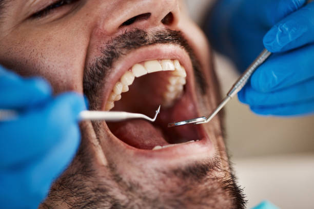 Best After-Hours Dental Trauma Care in Cadillac, MI