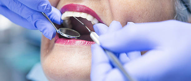 Best Emergency Root Canal Treatment in Cadillac, MI